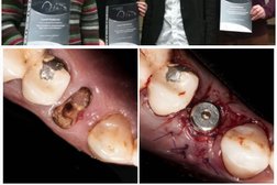 Стоматологическая клиника Альфа-Вита, с рейтингом 4.2 - находится по адресу Тверь, Краснофлотская набережная, 17 