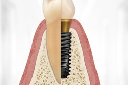 Компания Osstem implant, с рейтингом 4.8 - находится по адресу Москва, Андропова проспект, 18 к7 