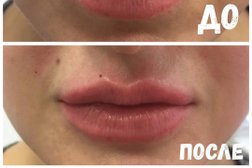 Косметология ЛазерМед, с рейтингом 3.6 - находится по адресу Курск, Дружининская улица, 7а 