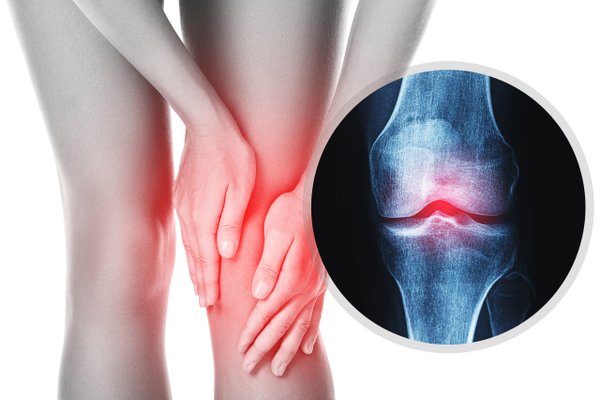 Pin on Knee pain